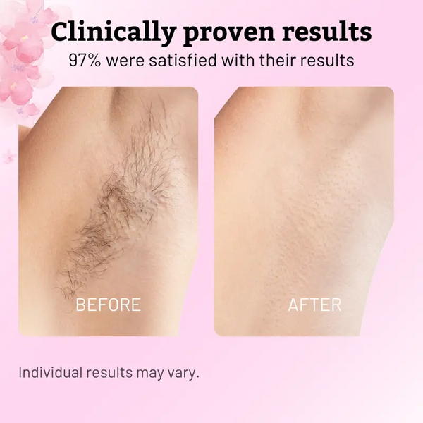 Óleo Pós-Barba Hidratante Tea Tree™